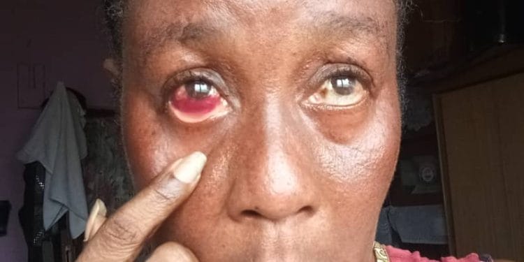 A Famous Face in an Inaudible Pain :How Diabetes Brought an Actress to Her Knees