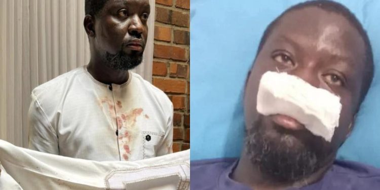 Ibrahim Mahama attacked, CAA Calls for probe